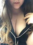 Su[F]Fered A Little Burn When I Was Younger, So Be Gentle With Me...