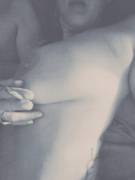 Cracked Rib [F]Rom Roller Derby &Amp;Amp;Amp; I Need Some Pots!!!!