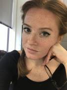 Lip Recovery After Dog Bite