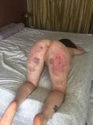 A Weekend [F]Ull Of Impact Fun. Bruises Are Truly Beautiful Ornaments 