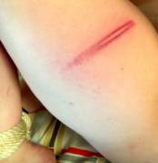 I Don't Want To Say I Deserved It, But I Deserved It. [F]