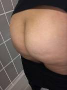 An Ass A Day, Keeps The Doctor Away? Is That How It Goes?