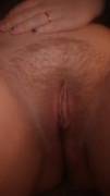 Vulva [F] 19