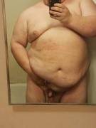 M 40 5'8&Amp;Quot; 359Lbs. Lost 90Lbs But I Am Still Upset About My Penis Size. I ...