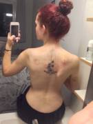 I'm Collecting Bite Marks (F)