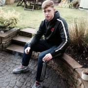 Before &Amp;Amp;Amp; After (X-Post /R/Scally)