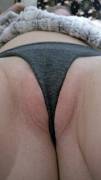 A [F]Orgiving Wedgie
