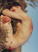 Mysterious Injuriesh