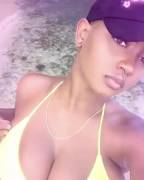 Front &Amp;Amp;Amp; Back.