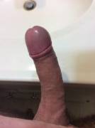 [18M] First Time Getting It Retracted Due To Phimosis And Pain, It's Bit Shy. Thoughts?