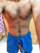 Just Some Agitated Precum Sitting At The Tip. Foreskinproblems.