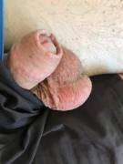 Brisbane Lads Foreskin