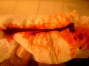 Gross Period Blood