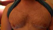 I Have Crop Circle Spirals On My Chest