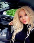 Addicted To Botox... Still Need Bigger Boobs