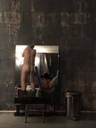 My View From The Sling, Before The Pounding Began