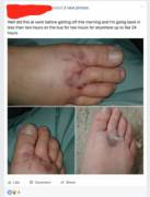 No One Wants To See Your Sickly Feet