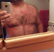 I Got Sunburnt, I Will Need Rubbed Down, Let's Start With The Head Of My Cock