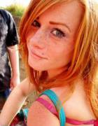 Freckles And A Couple Straps
