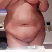 First Ever Tummy Pic. I'm So Nervous