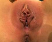 The Butterfly Is Open