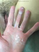 Hand Covered In Grool - Album On Imgur