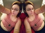 [20F] Hows Your Friday Going? Do Any Of You Guys Have Eczema, Especially On The Face, ...