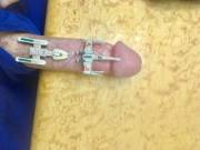 X-Wing Providing Cover Fire For The [M]Uch Slower, Y-Wing Bomber