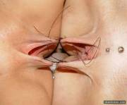 Looks Like A Good Time To Set Off The Fire Alarm.