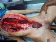 Just Let Me Leave This Here