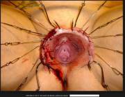 &Amp;Quot;Hooker&Amp;Quot; Vagina