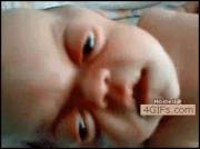 [Nsfw] Baby With Bulging Eyes