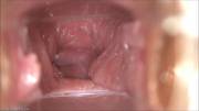 Insides Of A Vagina Slowly Closing Up