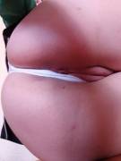 Another Sexy Photo Ass [F]