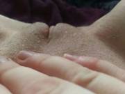 24 Yo Colorado Womb In Need Of Of Massive Loads N An Iud Removal