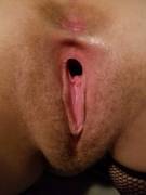 My Wife's Fuzzy Gape