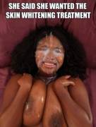 Skin Treatment