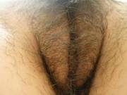 Hair Today, Gone Tomorrow