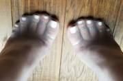 Toe Rings On Every Toe..!