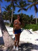 Looks Like She Banged Her Knee