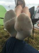 One Pic Of Our #Festivalfeet Series :3