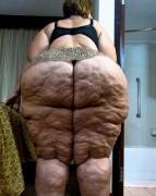 Cellulite: Cottage Cheese Buns! Add More In Comments