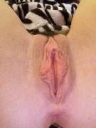 I've Always Been Self-Conscious Of Having Large Labia. I've Been With Two Guys And ...