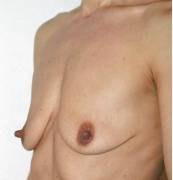 Flat. Very Flat. Pancake Flat. Saggy, And Omfg Nips!