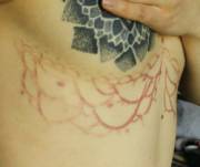 The Hand Poked Girl Has Scars Now #3