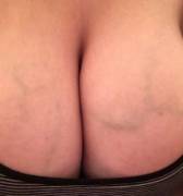 Now You See Them, Now You Don't (Them = My Nipples 