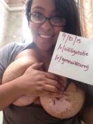 Officially Verified!! I Hope My Vitiligo Doesn't Scare Anyone Away.