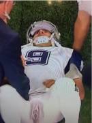 Leaked X-Ray Of Tony Romo's Injury