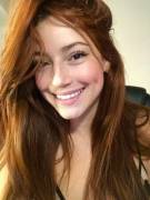 Dimple Is The Cutest Deformity