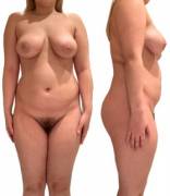 (20F, 5'3&Amp;Quot;, 150 Lbs) Self-Conscious About Bloated Stomach And Boob Gap. ...